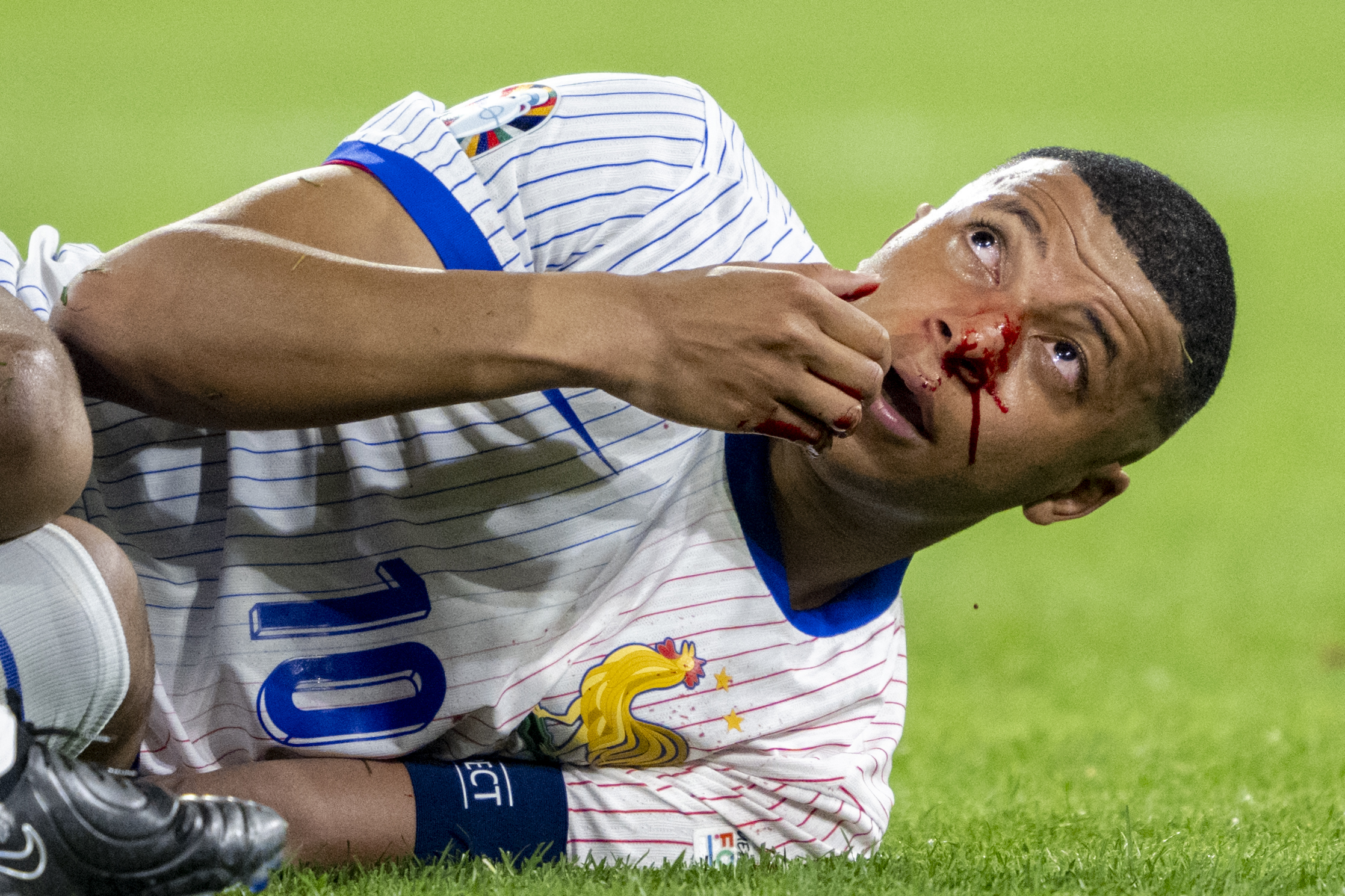 Fantaeuropeo, infortunio Mbappé: che guaio per la Francia e i fantallenatori! Quando rientra