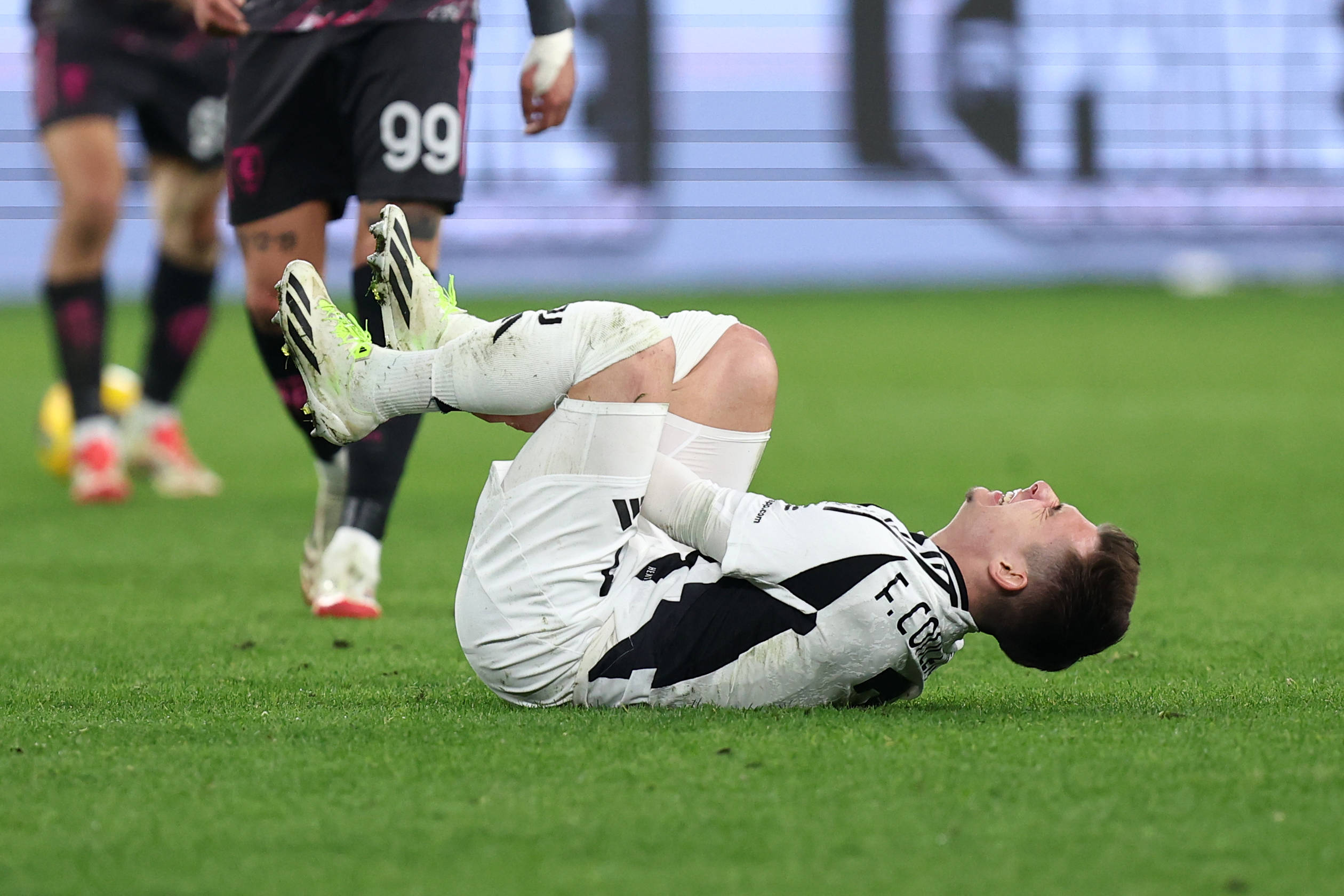 Juventus, quando torna Conceicao? Infortunio più serio del previsto, quante partite salta