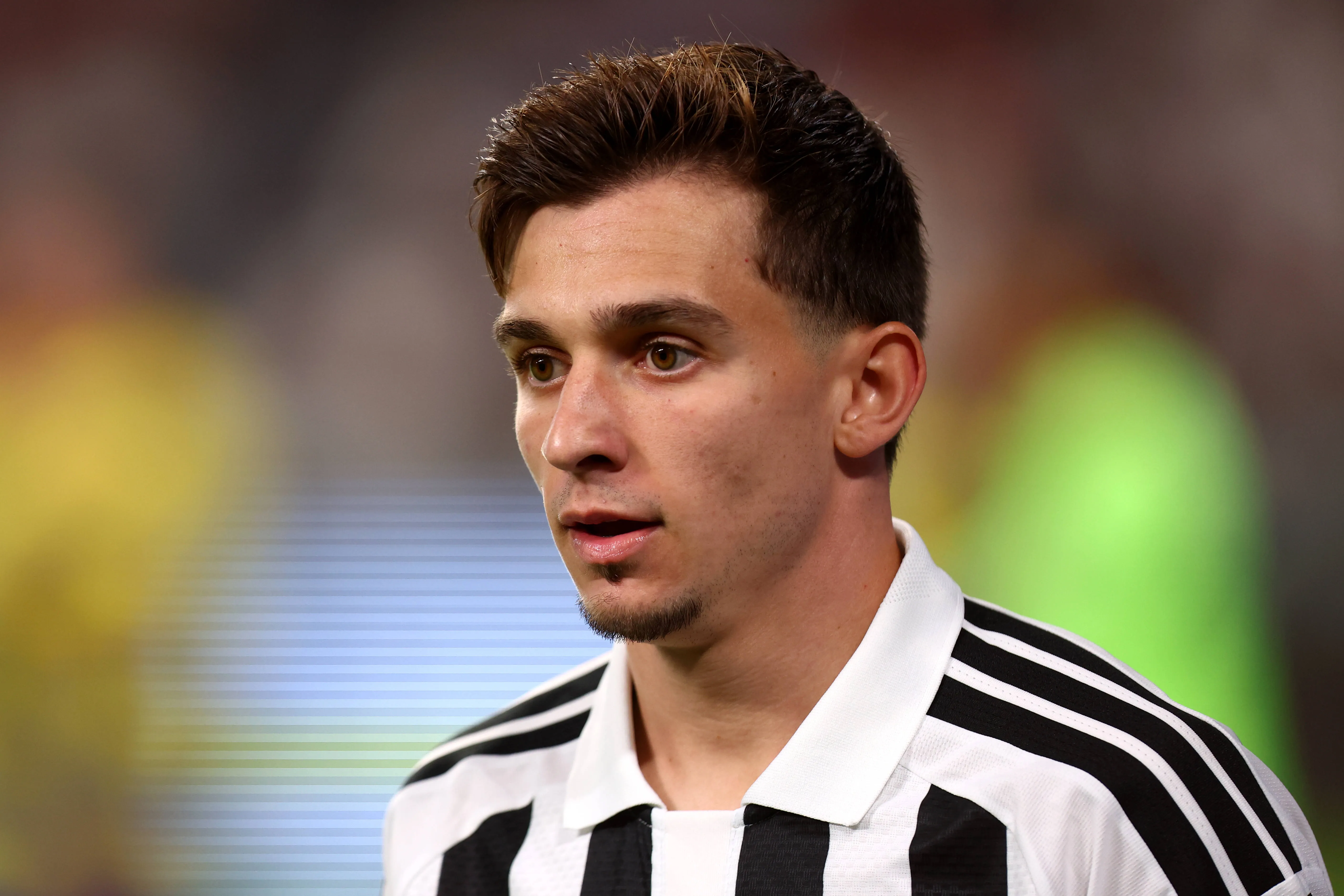 Juventus-Milan: pronostico, anteprima e probabili formazioni