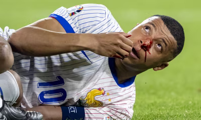 Fantaeuropeo, infortunio Mbapp&eacute;: che guaio per la Francia e i fantallenatori! Quando rientra